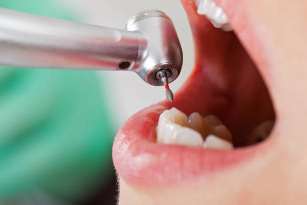 Best Walk-In Emergency Dentist in Bladenboro, NC